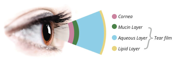 Dry eyes medical term